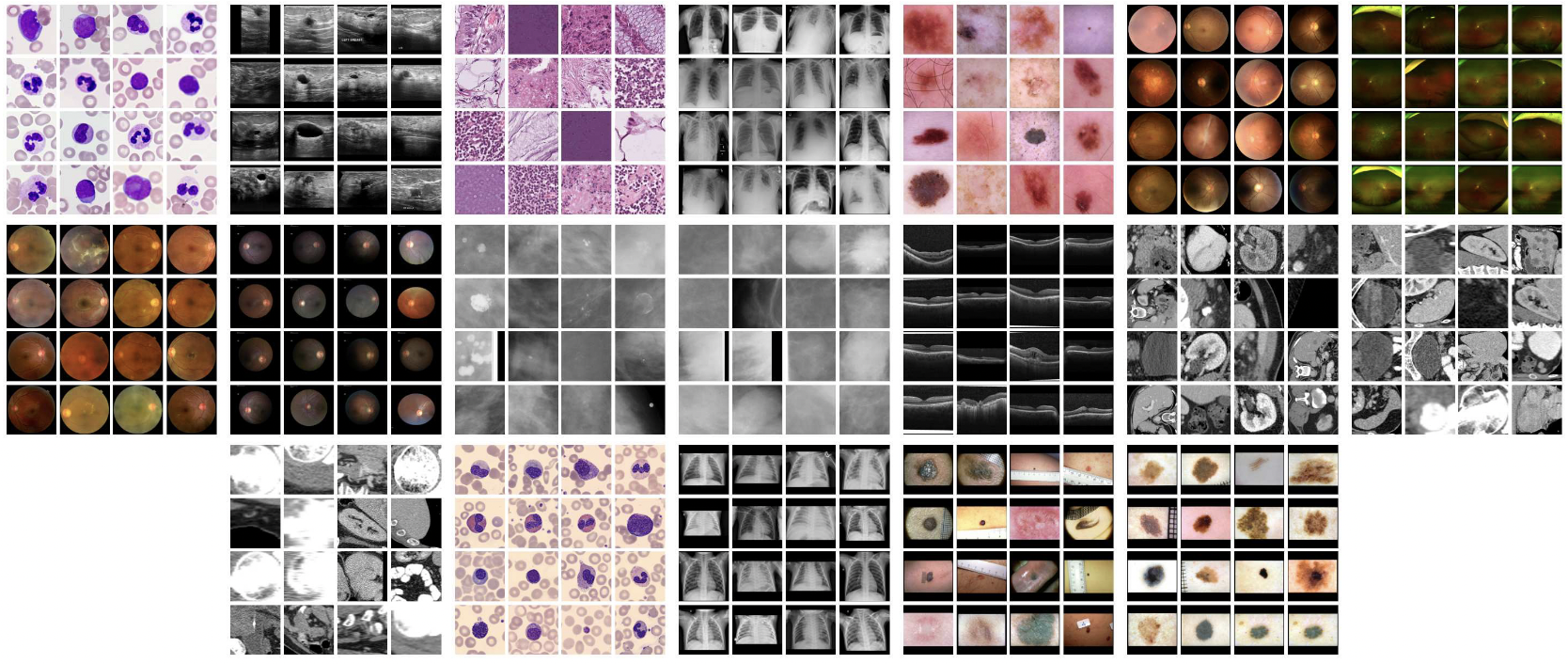 A comprehensive and easy-to-use multi-domain multi-task medical imaging meta-dataset